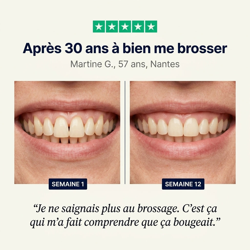 Ligne de gencive, semaine 1 et semaine 12
