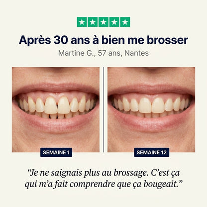 Lusivae, appareil à lumière rouge pour les gencives