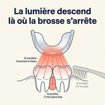 Lusivae, appareil à lumière rouge pour les gencives